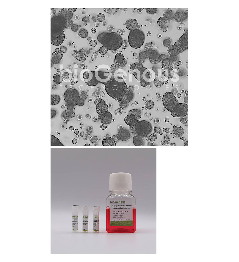 Lung Squamous Cell Carcinoma Organoid Kit肺鳞癌