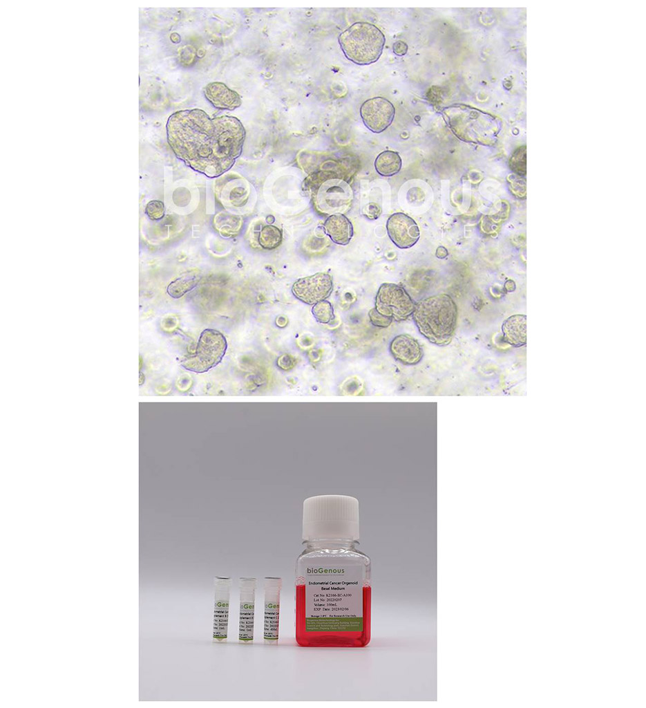 Endometrial Cancer Organoid Kit子宫内膜癌
