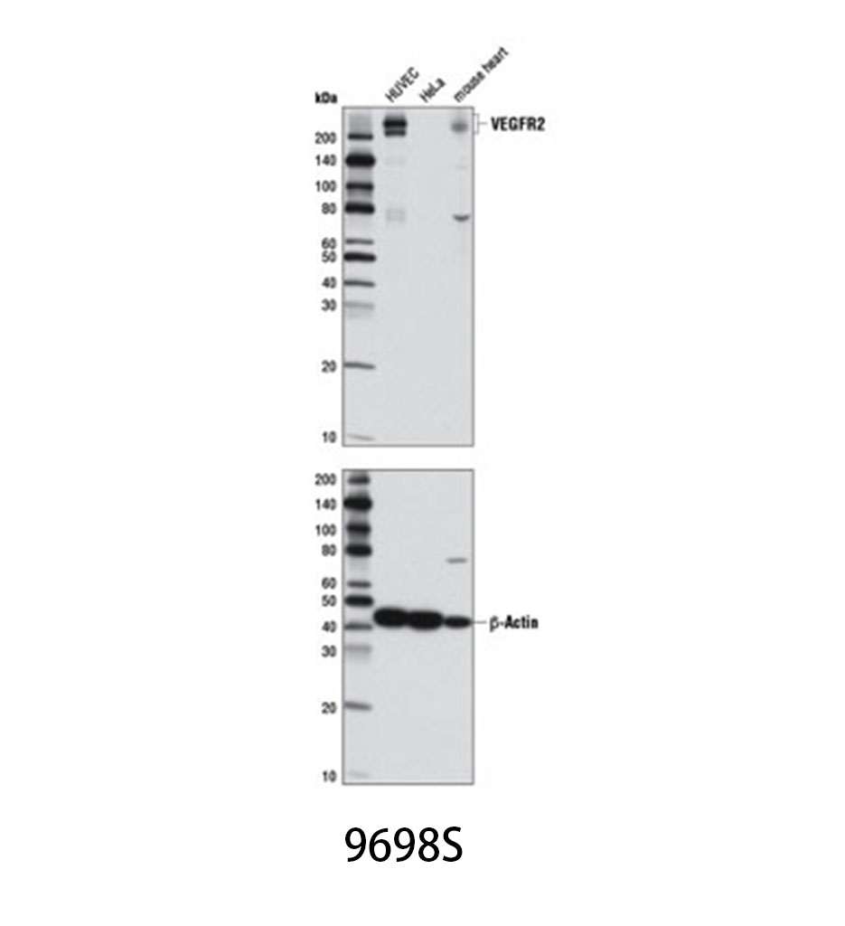VEGF Receptor 2 (D5B1) Rabbit mAb