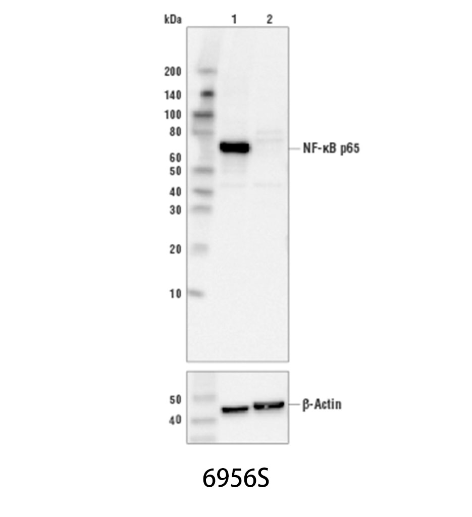 NF-κB p65 (L8F6) Mouse mAb