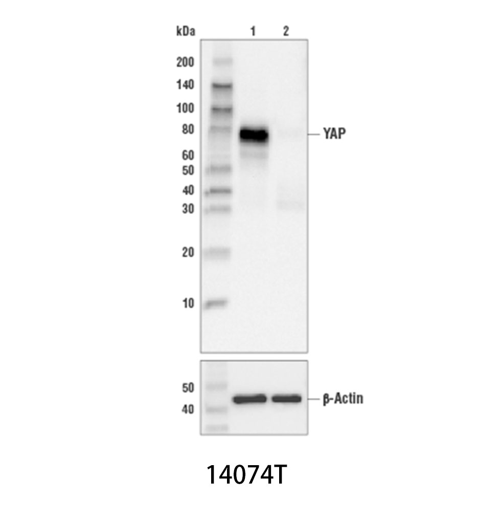 YAP (D8H1X) XP Rabbit mAb