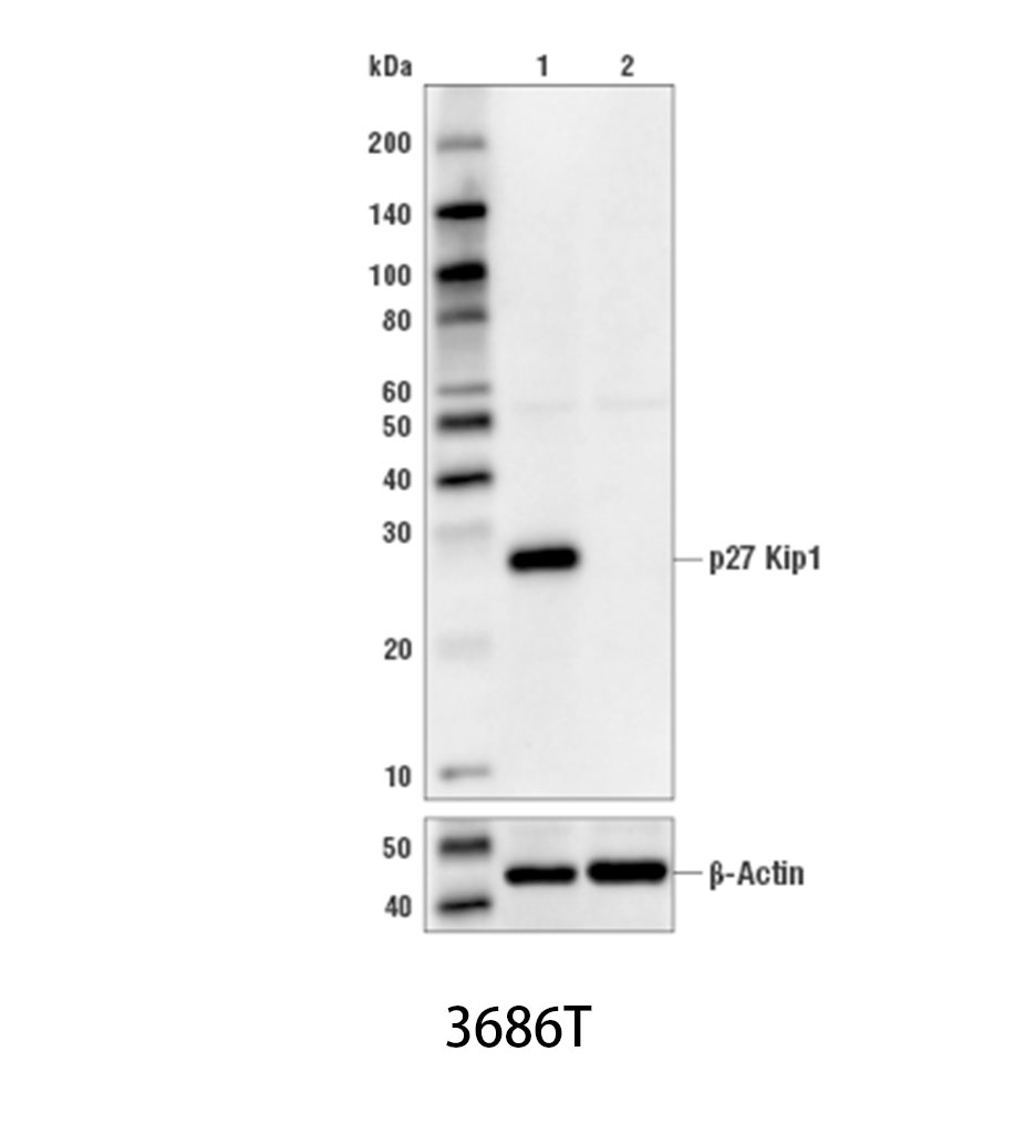 p27 Kip1 (D69C12) XP Rabbit mAb