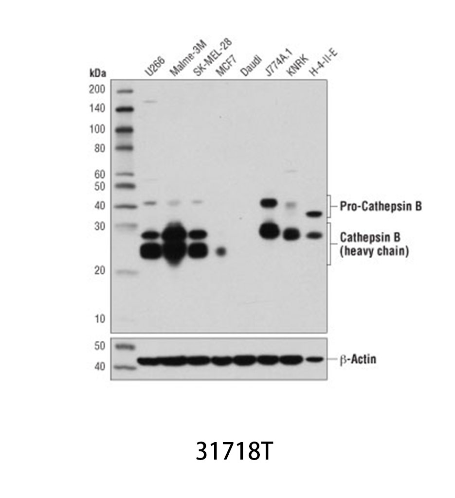 Cathepsin B (D1C7Y) XP Rabbit mAb