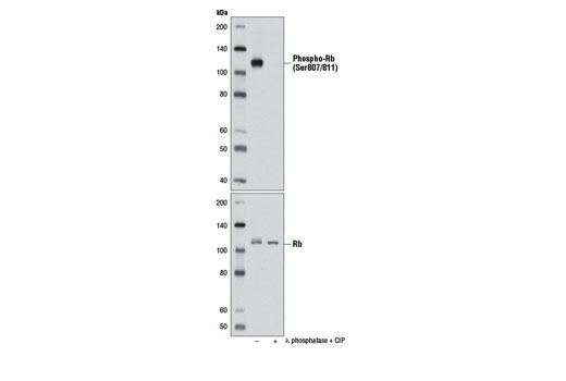 Phospho-Rb (Ser807/811) (D20B12) XP Rabbit mAb