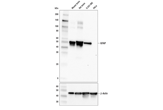 GFAP (E4L7M) XP Rabbit mAb