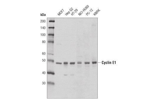 Cyclin E1 (D7T3U) Rabbit mAb