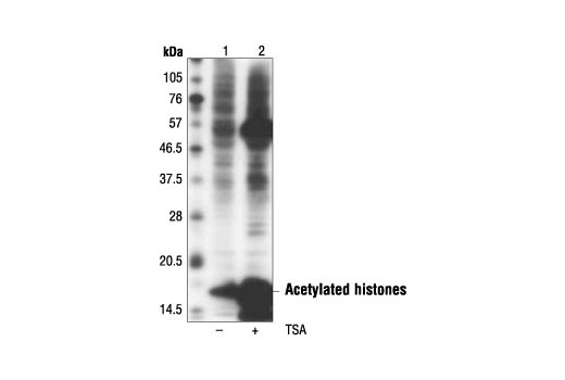 Acetylated-Lysine Mouse mAb (Ac-K-103)