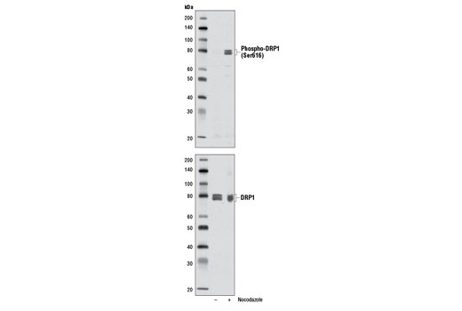 Phospho-DRP1 (Ser616) (D9A1) Rabbit mAb