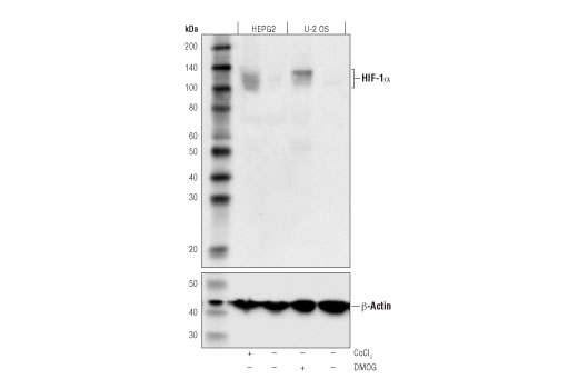 HIF-1α (D5F3M) Mouse mAb