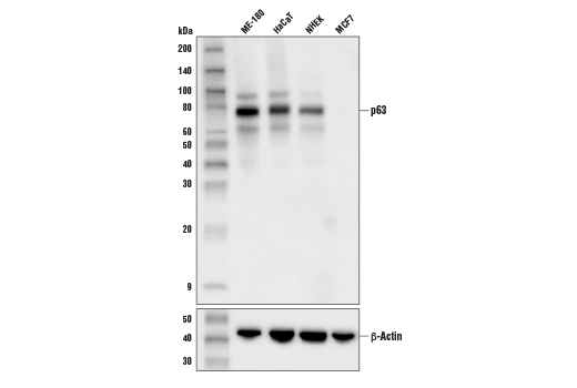 p63 (D9L7L) XP Rabbit mAb