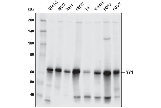 YY1 (D5D9Z) Rabbit mAb