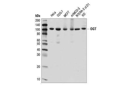 OGT (D1D8Q) Rabbit mAb