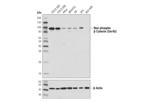 Non-phospho (Active) β-Catenin (Ser45) (D2U8Y) XP Rabbit mAb