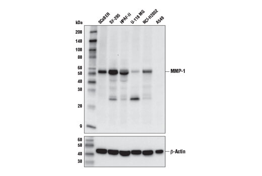 MMP-1 (E9S9N) Rabbit mAb