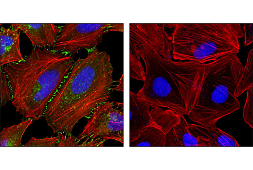 β-Catenin (L54E2) Mouse mAb (IF Preferred)