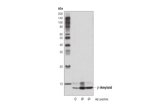 β-Amyloid (D3D2N) Mouse mAb