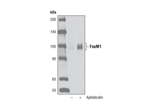 FoxM1 (D12D5) XP Rabbit mAb