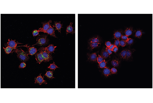 Phospho-STING (Ser365) (D1C4T) Rabbit mAb