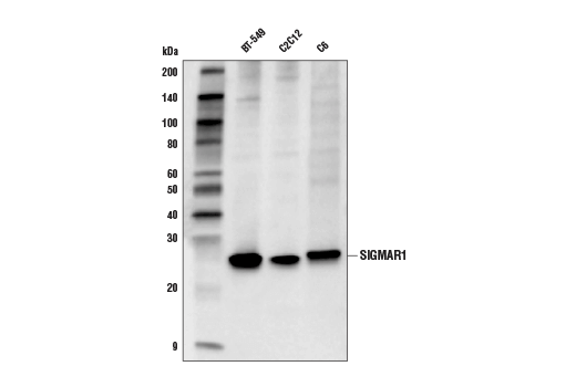SIGMAR1 (D4J2E) Rabbit mAb