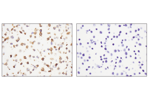 CXCR5 (D6L3C) Rabbit mAb (IHC Specific)