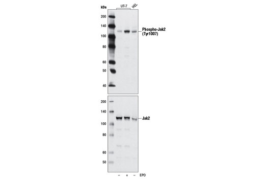 Phospho-Jak2 (Tyr1007) (D15E2) Rabbit mAb