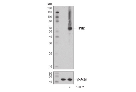 TPH2 (D3E5I) XP Rabbit mAb