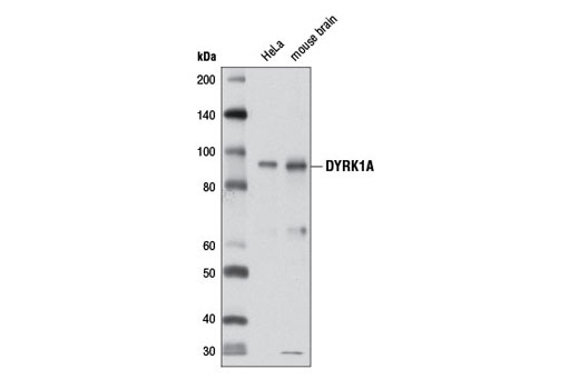 DYRK1A (D30C10) Rabbit mAb