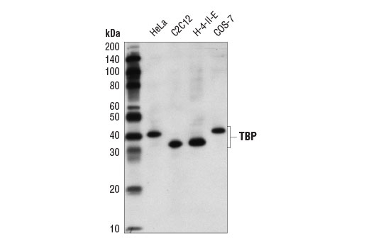 TBP (D5C9H) XP Rabbit mAb