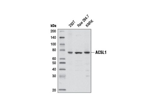 ACSL1 (D2H5) Rabbit mAb