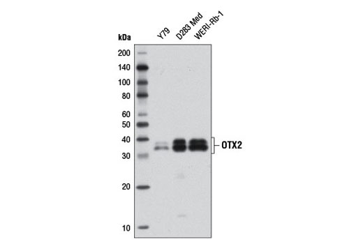 OTX2 (D7Y3J) Rabbit mAb