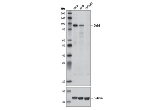 Dab2 (D7O9T) Rabbit mAb
