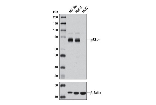 p63-α (D2K8X) XP Rabbit mAb