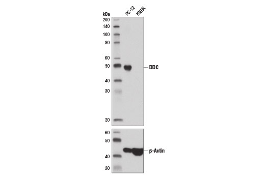 DDC (D6N8N) Rabbit mAb