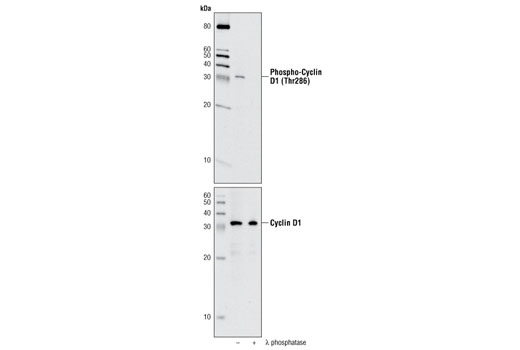 Phospho-Cyclin D1 (Thr286) (D29B3) XP Rabbit mAb