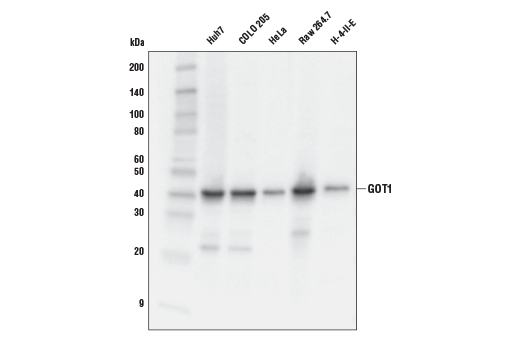 GOT1 (E4A4O) Rabbit mAb