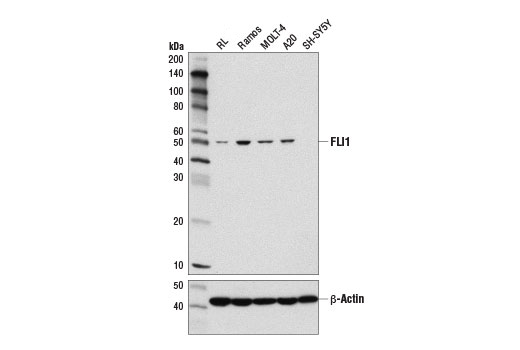 FLI1 (D7N5M) Rabbit mAb