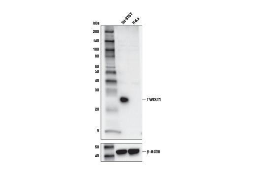 TWIST1 (E7E2G) Rabbit mAb