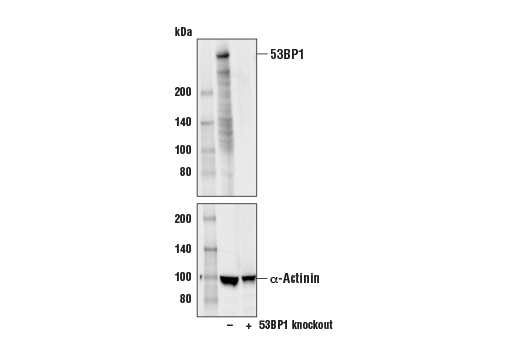 53BP1 (E7N5D) XP Rabbit mAb