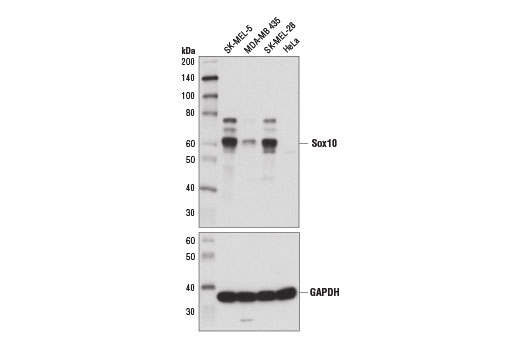 Sox10 (D5V9L) Rabbit mAb
