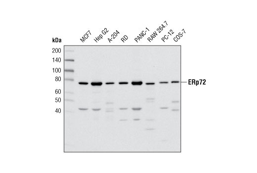 ERp72 (D70D12) XP Rabbit mAb