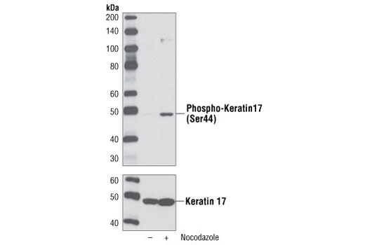 Phospho-Keratin 17 (Ser44) Antibody