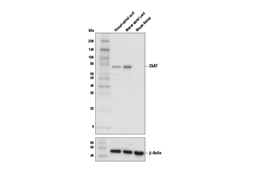 ChAT (E4F9G) Rabbit mAb