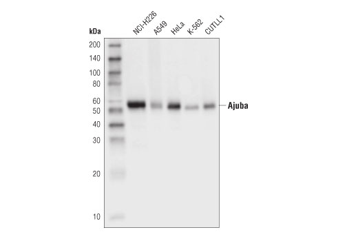 Ajuba (D4D8P) Rabbit mAb