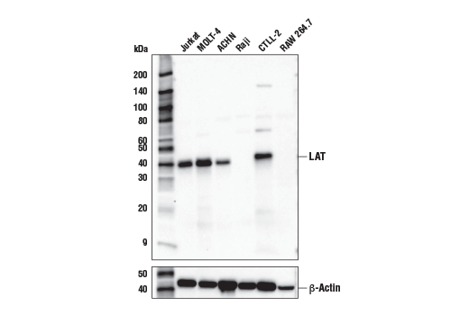LAT (E3U6J) XPRabbit mAb