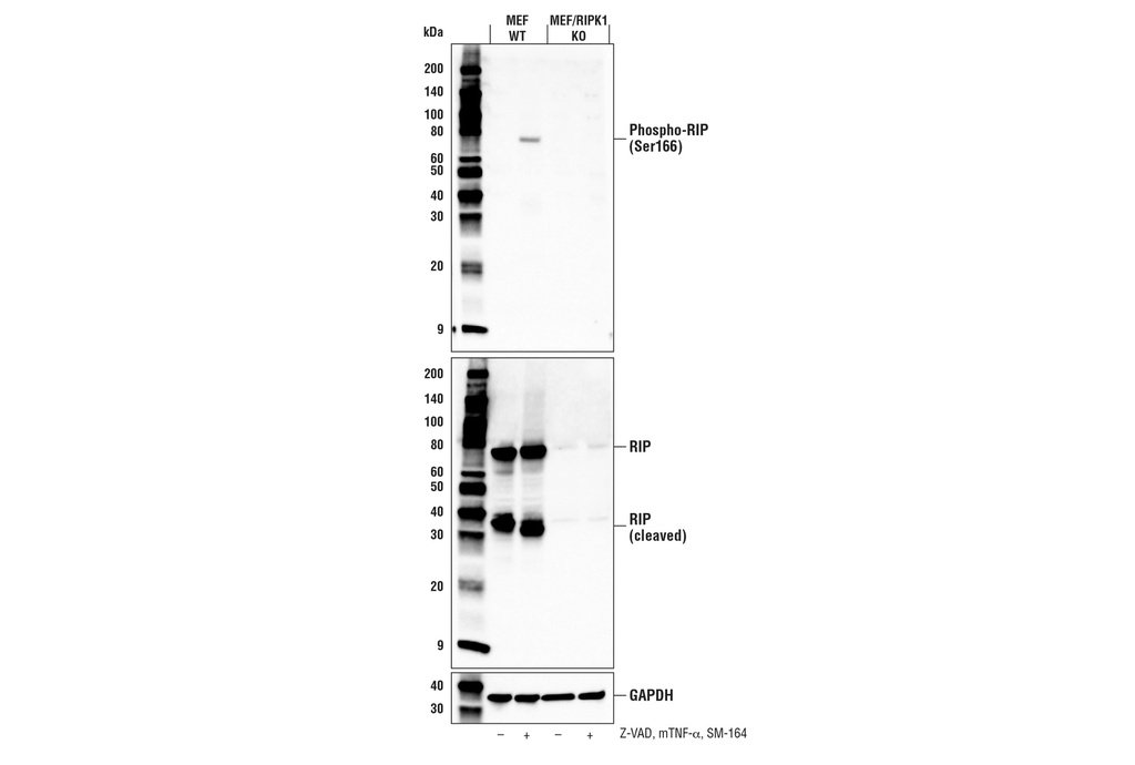Phospho-RIP (Ser166) (E7G6O) Rabbit mAb