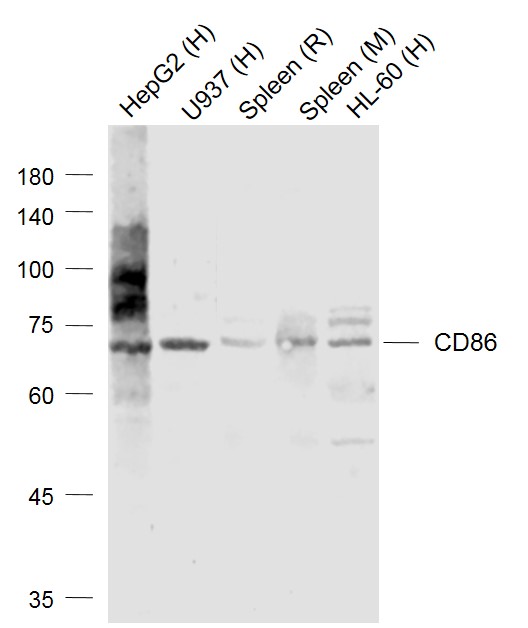 CD86抗体