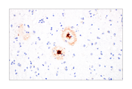 beta-Amyloid (1-42) (E6D5M) Rabbit Monoclonal Antibody