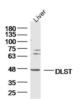 DLST蛋白抗体