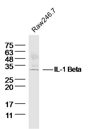 白介素1b/IL-1b抗体