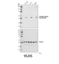 Phospho-Smad3 (Ser423/425) (C25A9) Rabbit mAb
